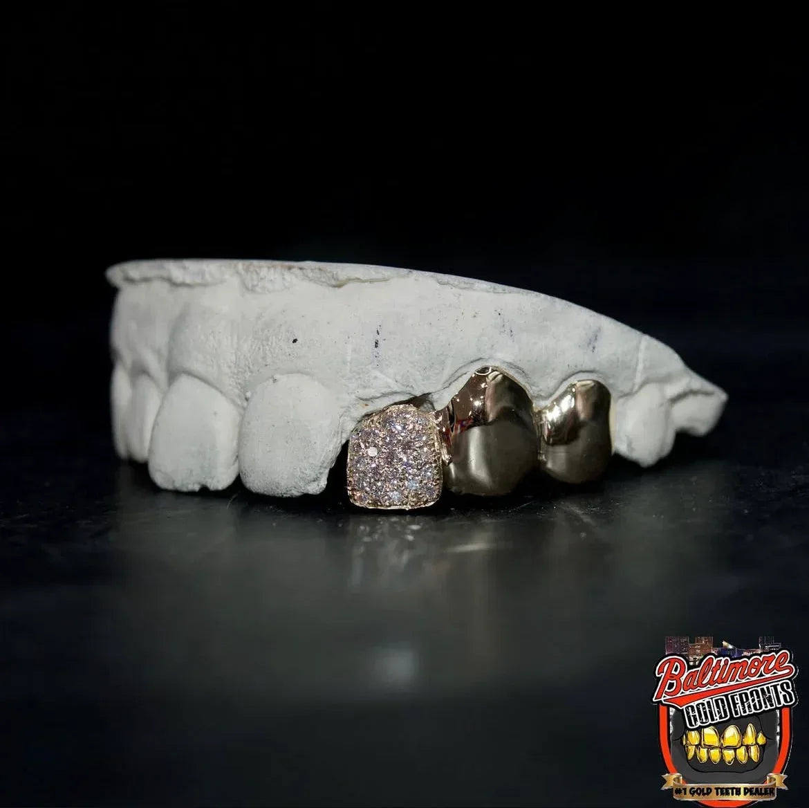 3 Gold Teeth: Stone Encrusted Tooth With 2 Solids image 2