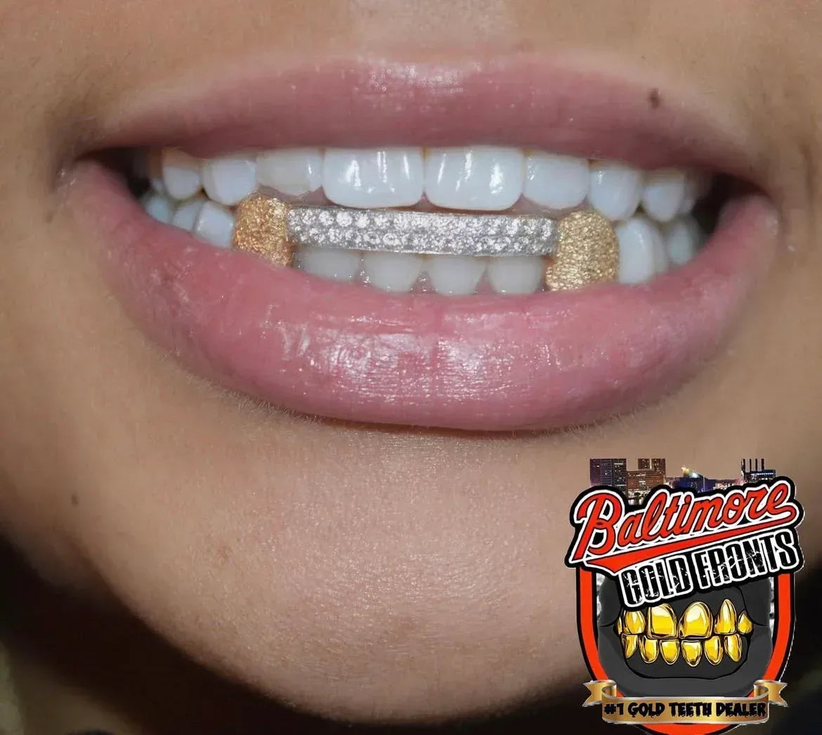 6 teeth: double bridge with 2 diamond dust k9's image 2