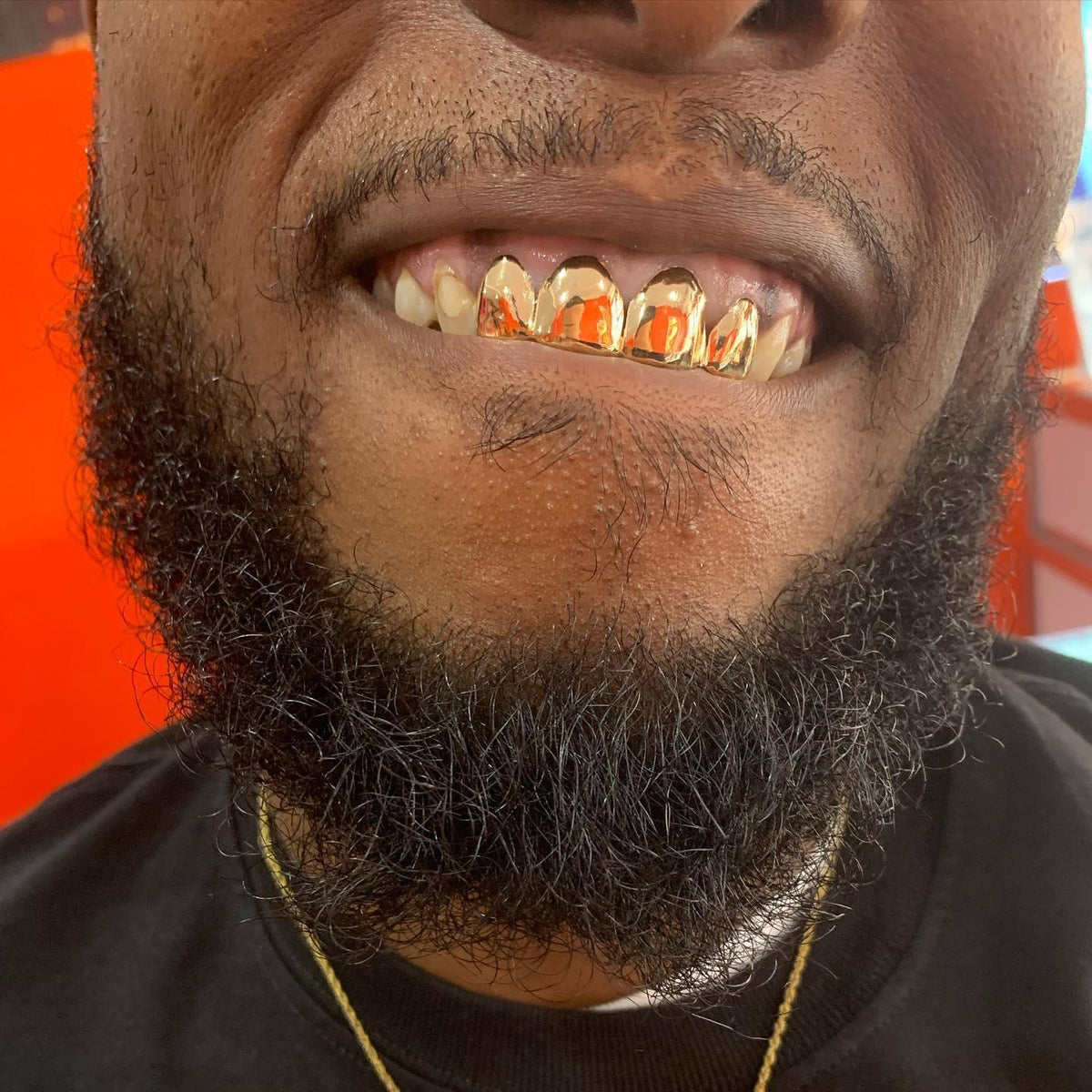 4 Gold Teeth: 10k - 22k Tops Grillz image 0