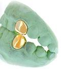 1 Gold Tooth "SINGLE CAP": TOP OR BOTTOM 10K-22K image 1
