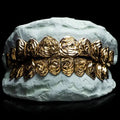 10 Gold Teeth: 10-22K Tops or Bottoms image 4