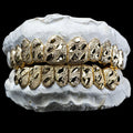 10 Gold Teeth: 10-22K Tops or Bottoms image 0