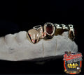 5 Gold Teeth: Front Bridge with Ruby incisors image 2