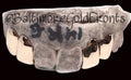 10k Gold 4 Solid Plain w/ Back Bridge image 0