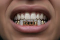8 Gold Teeth: Stone Encrusted Piece Front Bar with K9's image 0
