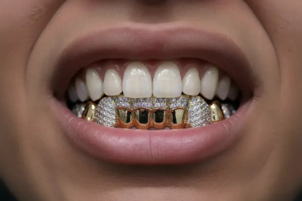 8 Gold Teeth: Stone Encrusted Piece Front Bar with K9's image 0