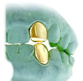 1 Gold Tooth "SINGLE CAP": TOP OR BOTTOM 10K-22K image 0